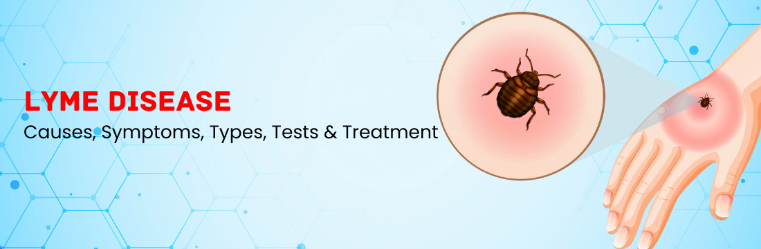 Lyme Disease: Causes, Symptoms, Types, Tests & Treatment